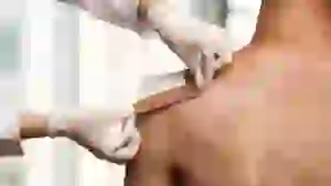 mikrornk-kodiruet-zazhivlenie-ran