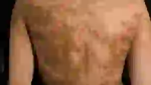 nasha-kozha-pokryta-nevidimymi-polosami