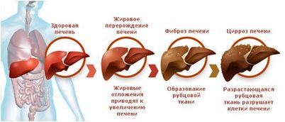 гепатит гепатит