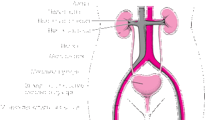 Как ИМП у женщин могут повредить почки