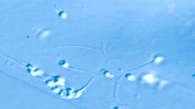 кариозным процессом