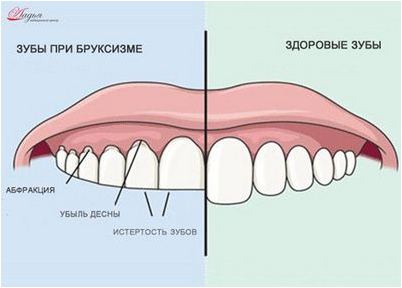 несоответствующий